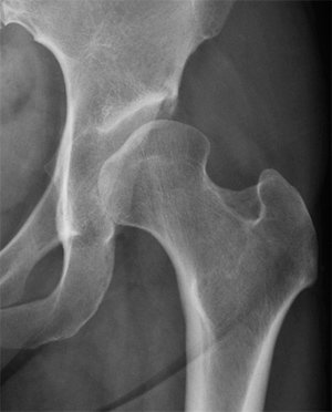 Stacks Image 1874